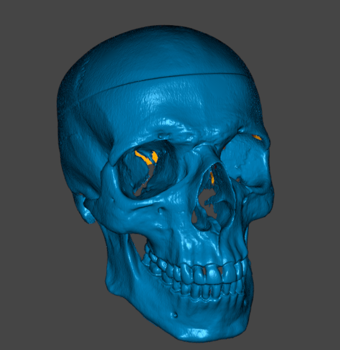 skull laser